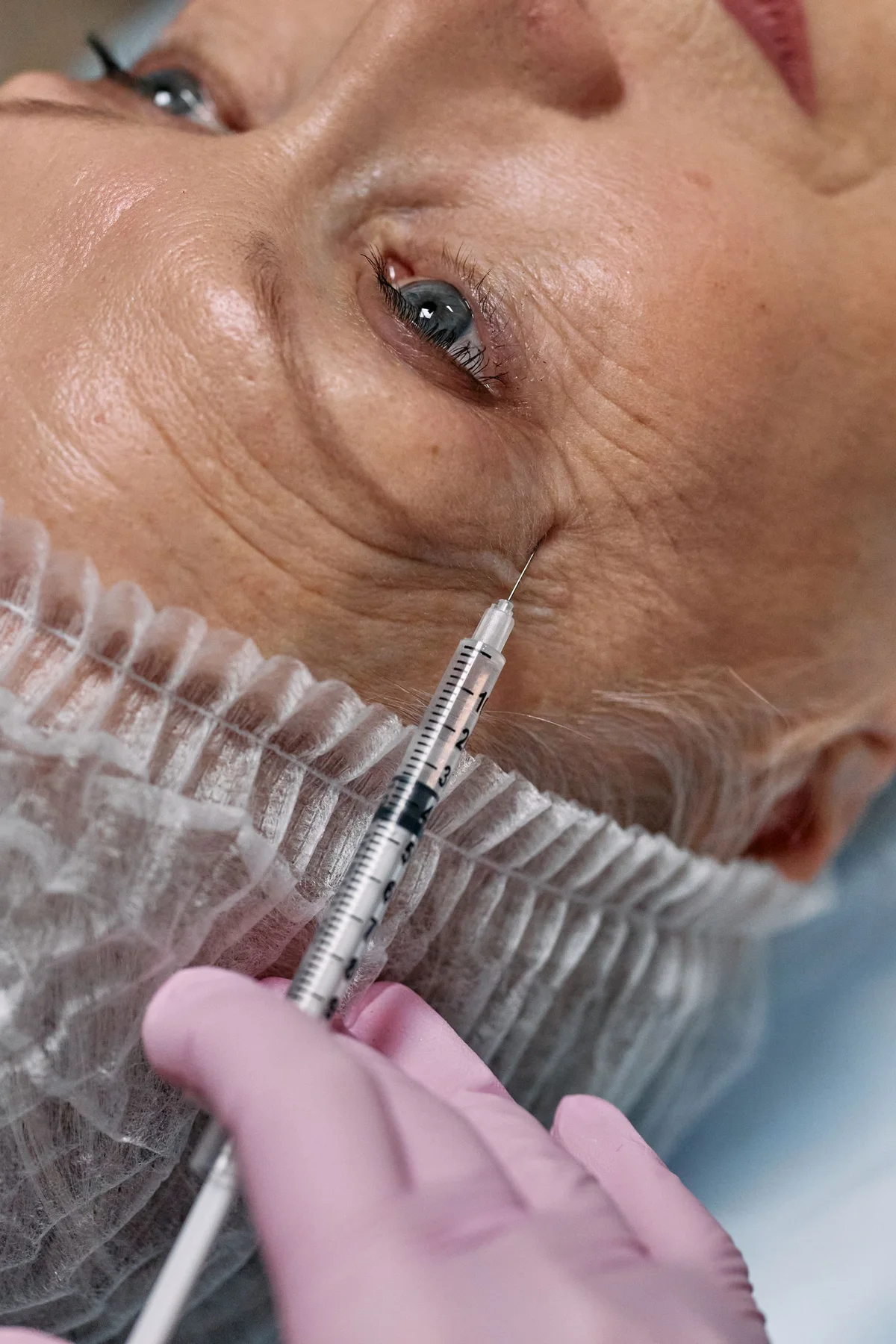 Close-up of a non-graphic injectable facial treatment